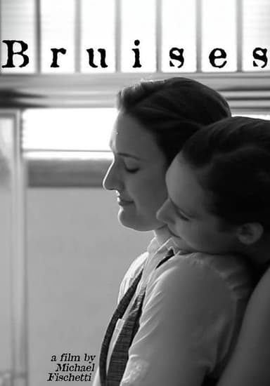 Bruises
